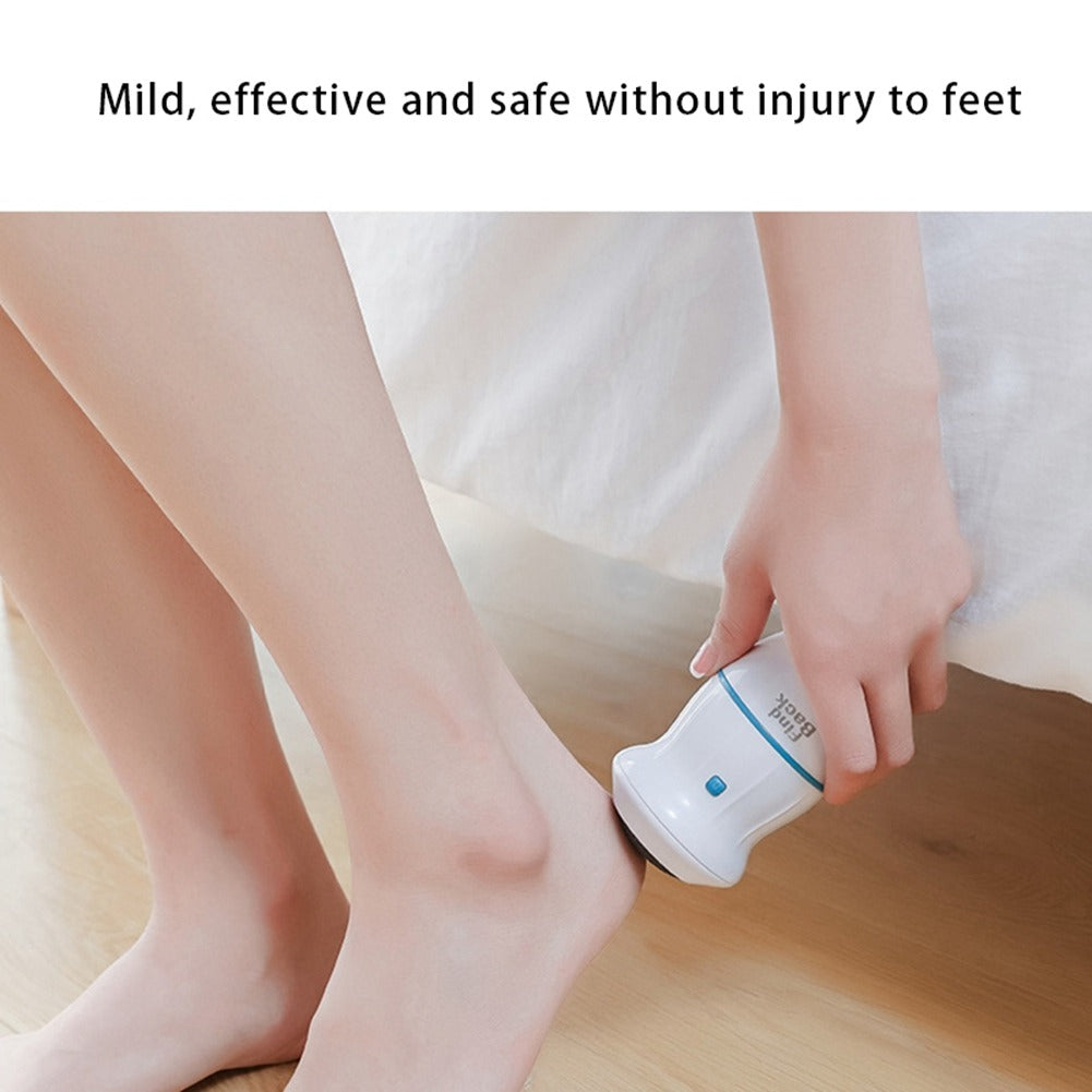 Rechargeable Callus Remover with Vacuum -Dead Skin, Cracked Heels