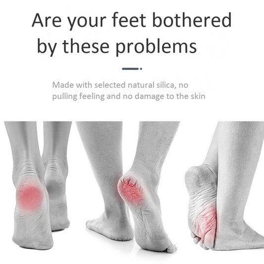Rechargeable Callus Remover with Vacuum -Dead Skin, Cracked Heels